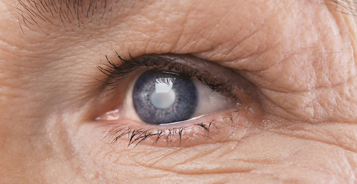 mencegah glaukoma kongenital