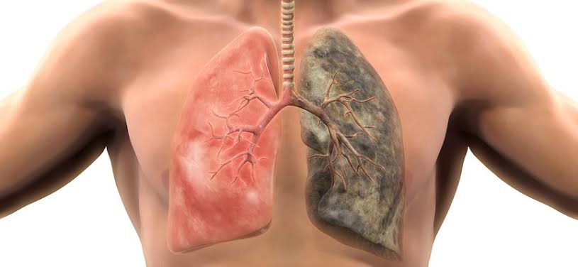 mengurangi risiko terkena kanker paru paru